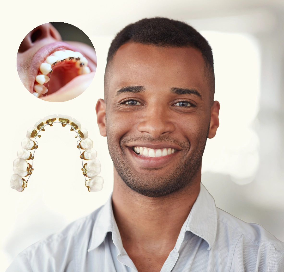 5 Benefits Of Wearing Dental Braces